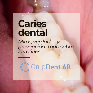 Caries Dental. Mitos, verdades y prevención