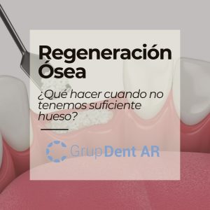 Regeneración Ósea e Implantes