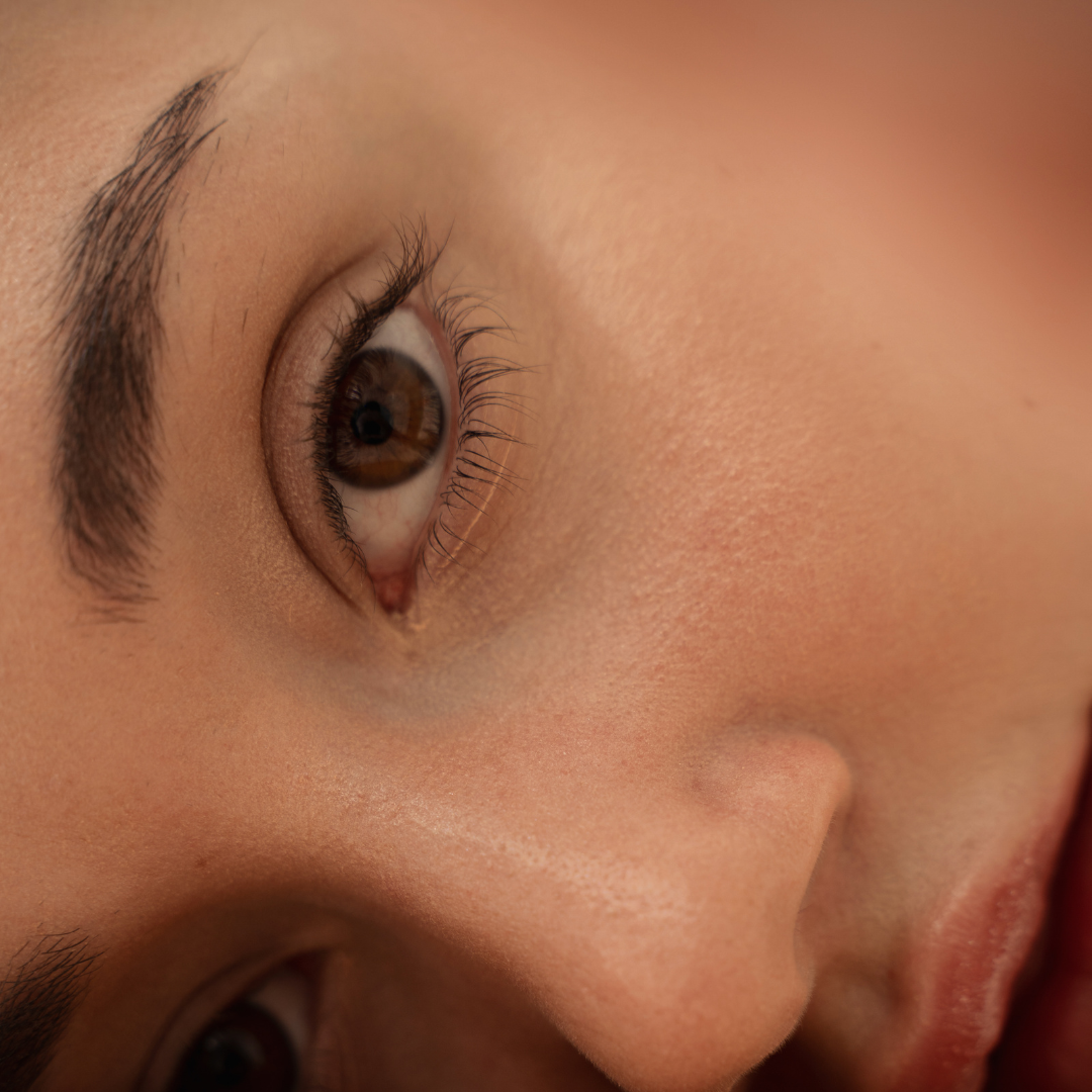 tratamiento-antiojeras