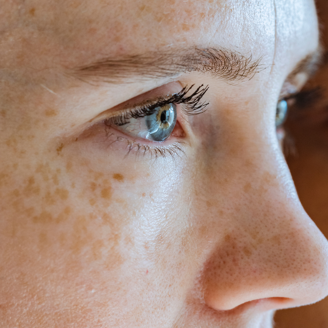 vitamica-c-tratamiento