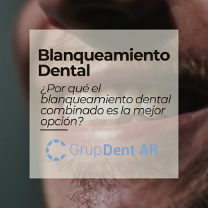 Blanqueamiento Dental Combinado: Resultados Duraderos