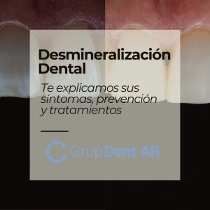 ¿Cómo tratar manchas blancas dientes?
