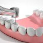 ODONTOLGIA conservadora